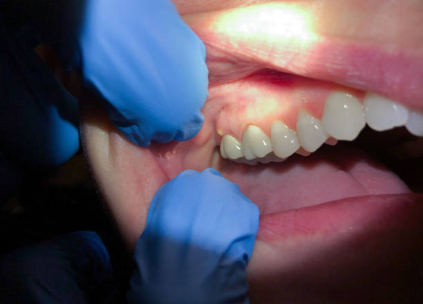 Best Walk-In Emergency Dentist in Kaser, NY
